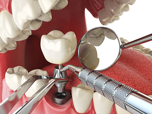 Best Urgent Care for Lost Fillings or Crowns in Panaca, NV